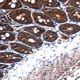 Frizzled 9 antibody [N1N2], N-term (GTX100169)